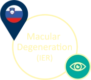 Macular Degeneration (IER)